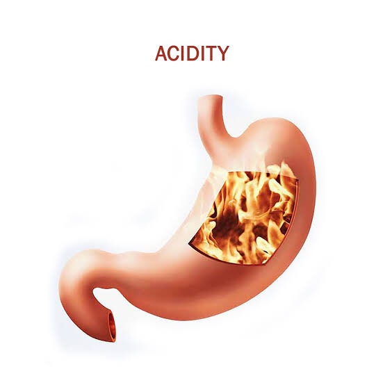 Your Ultimate Guide to Acidity Cure